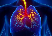 Asthma and Lung Cancer - Evaluating the Potential Risk Factors