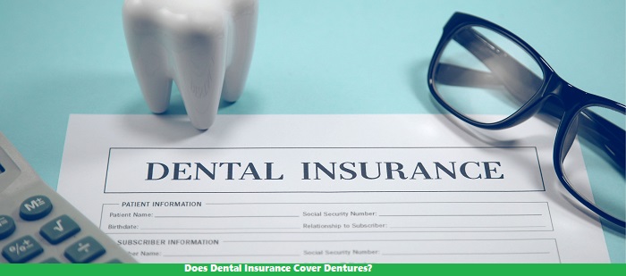 Does Dental Insurance Cover Dentures? - Review of Hosting, Insurance